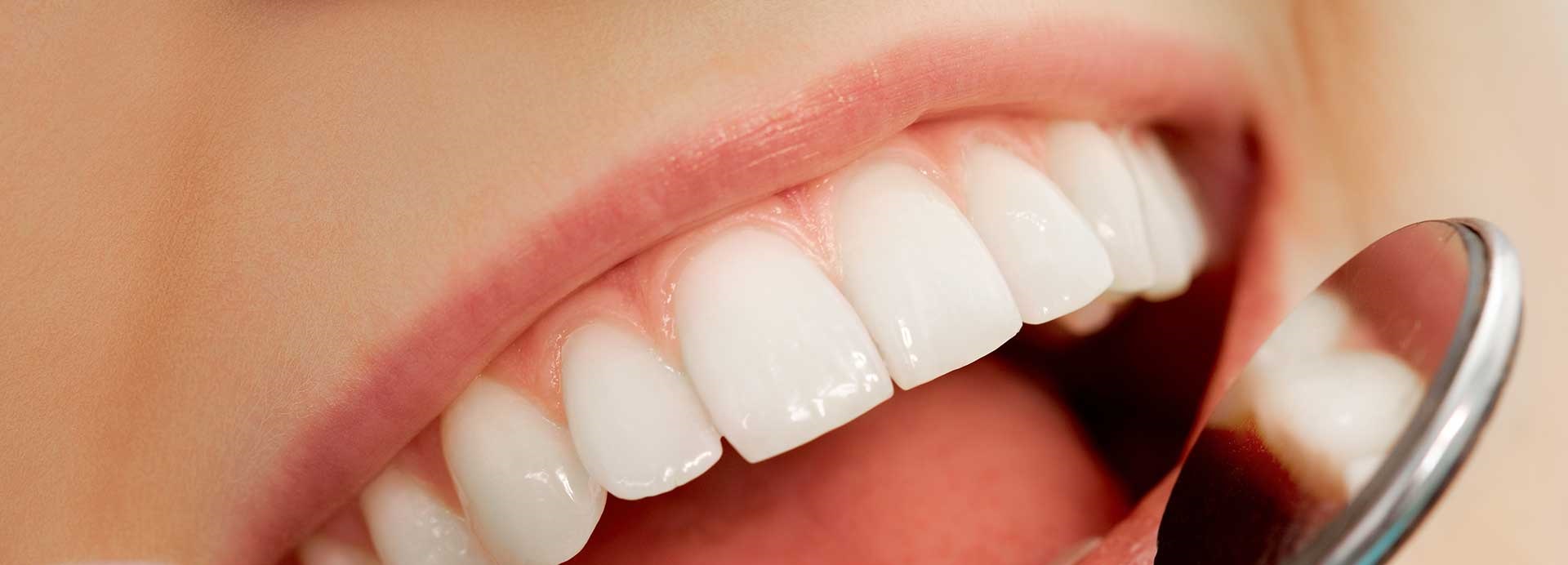 Dental Crowns & Bridges